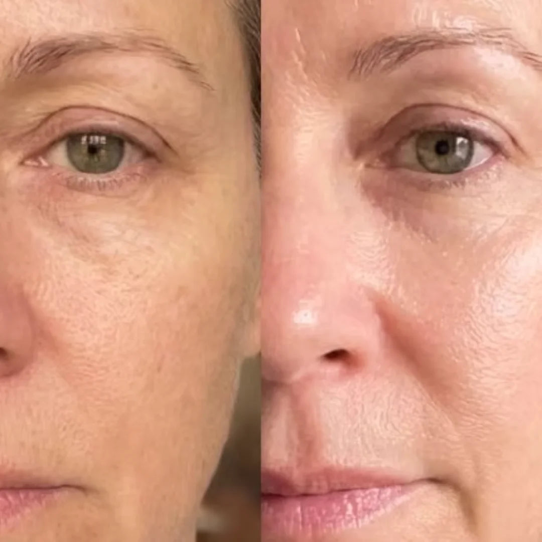 Antes e depois do uso da máscara