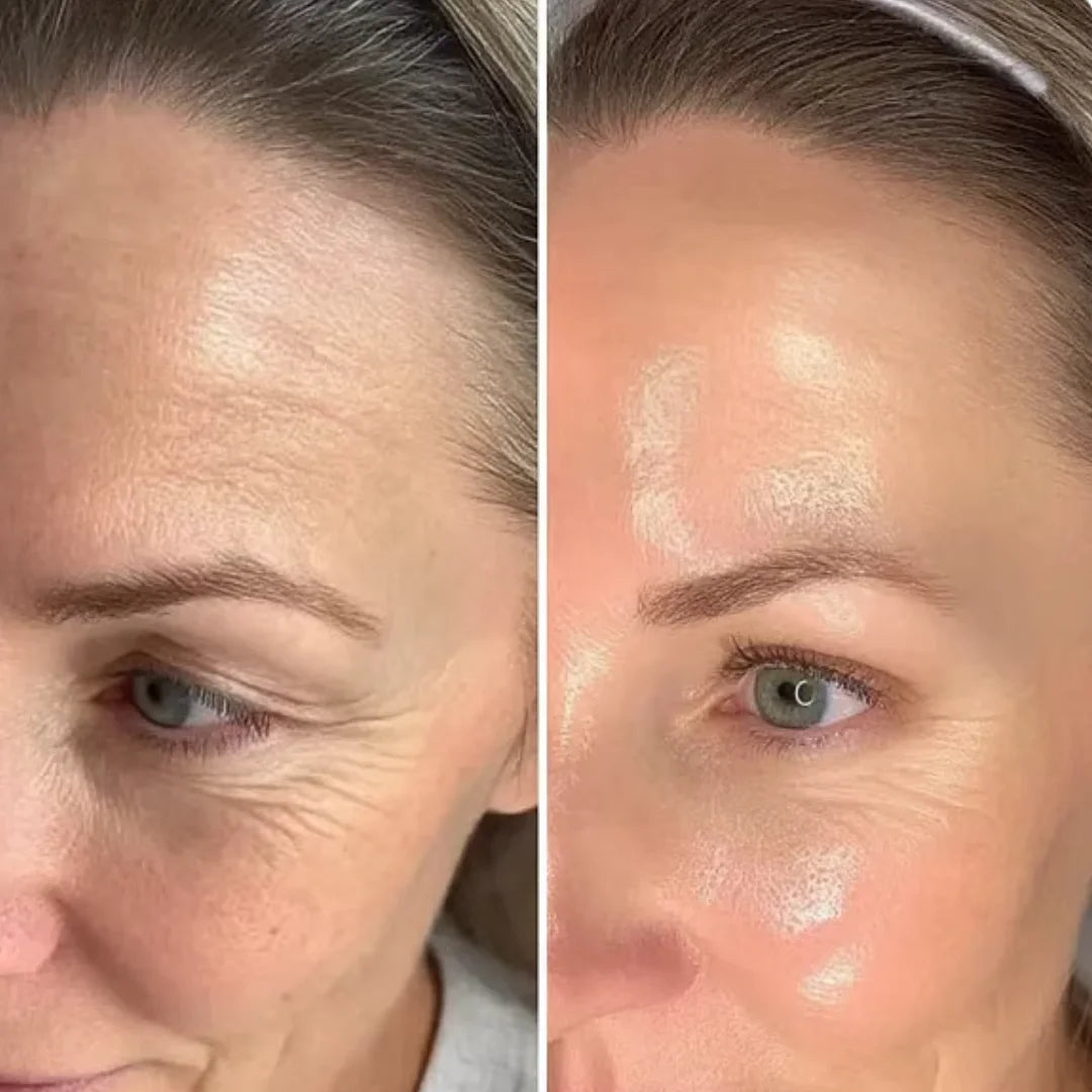Antes e depois do uso da máscara