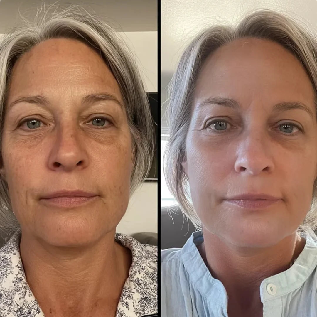 Antes e depois do uso da máscara