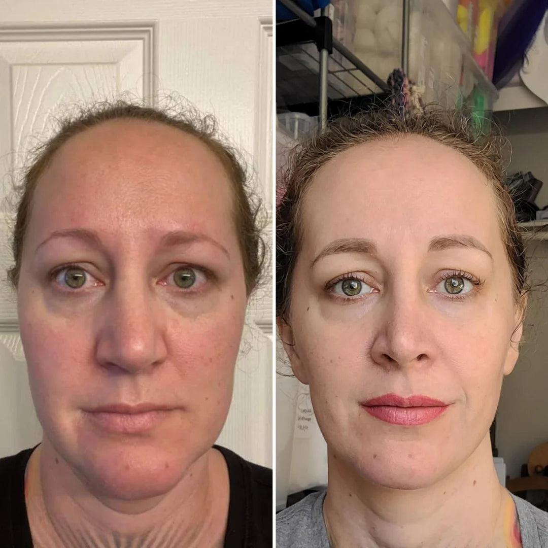 Antes e depois do uso da máscara