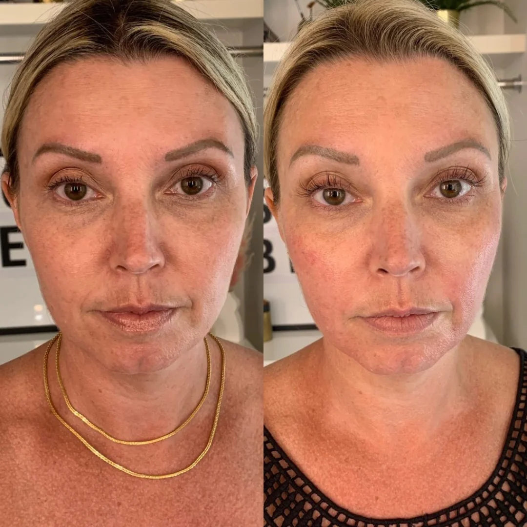Antes e depois do uso da máscara