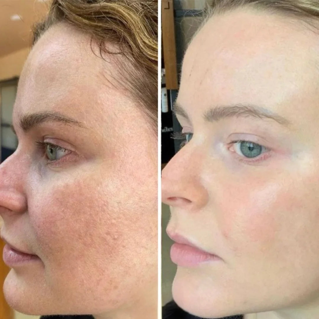 Antes e depois do uso da máscara