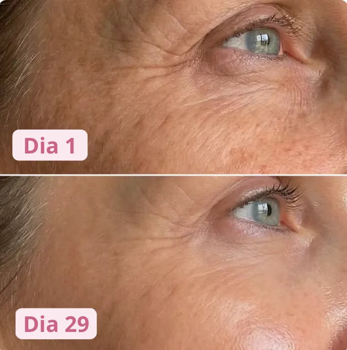 Pele no dia 1 e no dia 29 de uso
